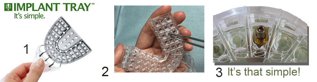 Implant Tray