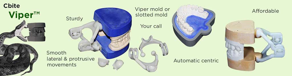 Viper Hinge Articulator